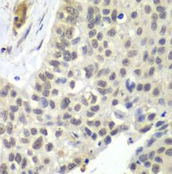 SNRPD2 Antibody