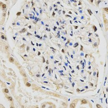 SNRPE Rabbit Polyclonal Antibody