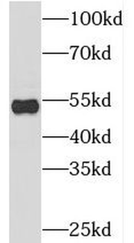 SNX27 Rabbit Polyclonal Antibody
