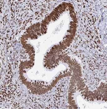 SNX27 Rabbit Polyclonal Antibody