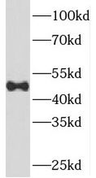 SNX5 Rabbit Polyclonal Antibody