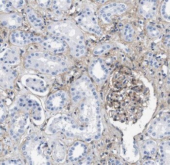 SNX5 Rabbit Polyclonal Antibody