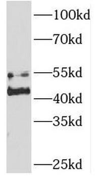 SNX7 Rabbit Polyclonal Antibody