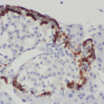 SNX7 Rabbit Polyclonal Antibody