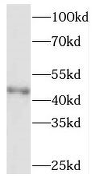 SOAT2 Antibody