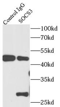 SOCS3 Antibody