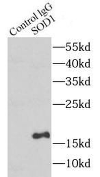 SOD1 Rabbit Polyclonal Antibody