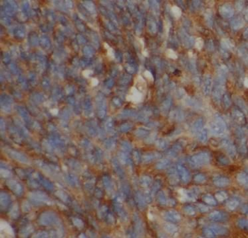 SOD1 Rabbit Polyclonal Antibody