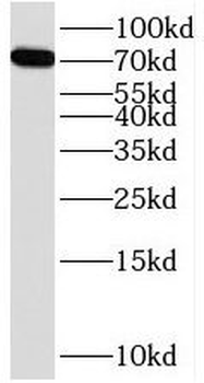SORBS1 Rabbit Polyclonal Antibody