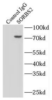 SORBS2 Rabbit Polyclonal Antibody