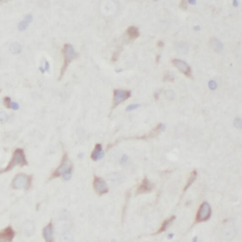 SORT1 Antibody