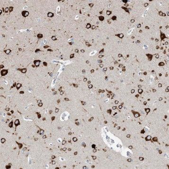 SOX10 Rabbit Polyclonal Antibody