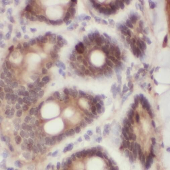 SOX7 Rabbit Polyclonal Antibody