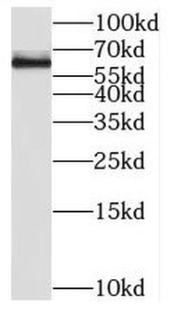 SP110 Rabbit Polyclonal Antibody