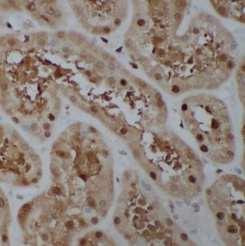 SPACA1 Rabbit Polyclonal Antibody