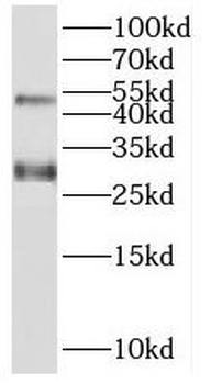 SPACA3 Rabbit Polyclonal Antibody
