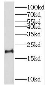 SPAG11A Rabbit Polyclonal Antibody