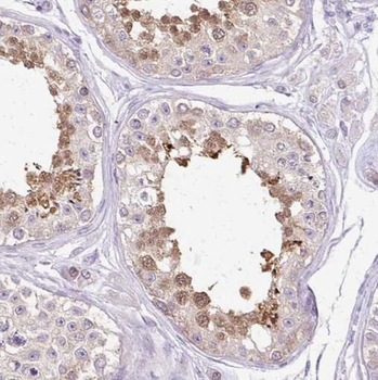 SPAG11A Rabbit Polyclonal Antibody
