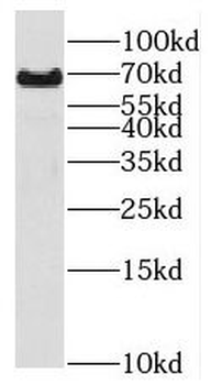SPAG16 Rabbit Polyclonal Antibody