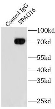 SPAG16 Rabbit Polyclonal Antibody