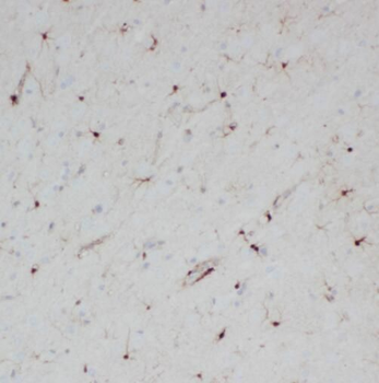 SPAG16 Rabbit Polyclonal Antibody