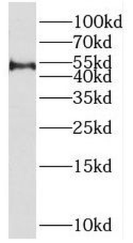 SPAG6 Rabbit Polyclonal Antibody