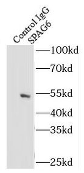 SPAG6 Rabbit Polyclonal Antibody