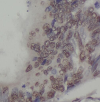 SPAG7 Rabbit Polyclonal Antibody