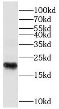 SPANXC Rabbit Polyclonal Antibody