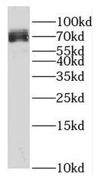 SPATA13 Rabbit Polyclonal Antibody