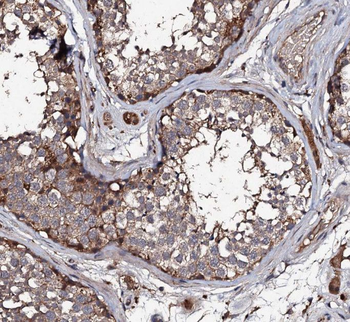 SPATA3 Rabbit Polyclonal Antibody
