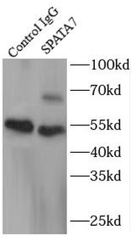 SPATA7 Rabbit Polyclonal Antibody