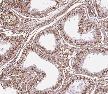 SPATA7 Rabbit Polyclonal Antibody