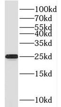 SPCS2 Rabbit Polyclonal Antibody