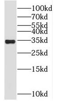 SRM Rabbit Polyclonal Antibody