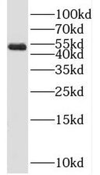 CBY2 Rabbit Polyclonal Antibody