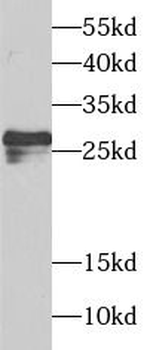 SPIN2B Rabbit Polyclonal Antibody