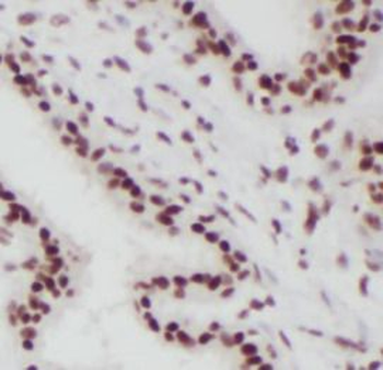 SPIN2B Rabbit Polyclonal Antibody