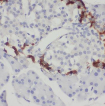 SPINK1 Rabbit Polyclonal Antibody