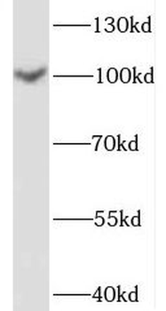SPOCD1 Rabbit Polyclonal Antibody