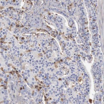 SPON2 Rabbit Polyclonal Antibody