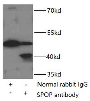 SPOP Rabbit Polyclonal Antibody