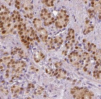 SPOP Rabbit Polyclonal Antibody