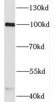 HM13 Rabbit Polyclonal Antibody