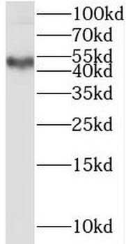 SPRED2 Rabbit Polyclonal Antibody