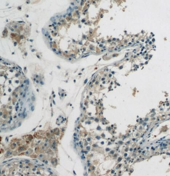 SPRED2 Rabbit Polyclonal Antibody