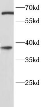 SPRY2 Rabbit Polyclonal Antibody
