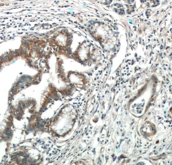 SPRY2 Rabbit Polyclonal Antibody