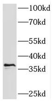 SPRY4 Rabbit Polyclonal Antibody