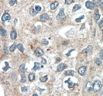 SPRY4 Rabbit Polyclonal Antibody